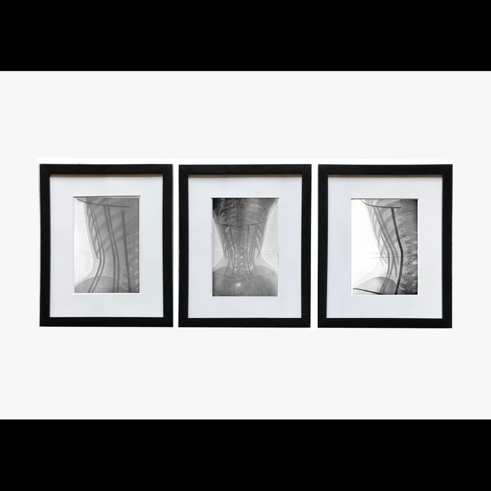 COPY - 3 Framed Prints of X-Ray Study in Corsets